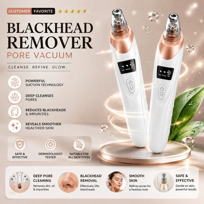 Blackhead Remover Vacuum – Rechargeable Pore Cleaner with Suction Control