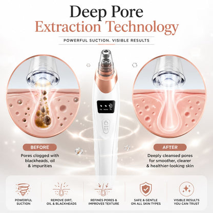Blackhead Remover Vacuum – Rechargeable Pore Cleaner with Suction Control