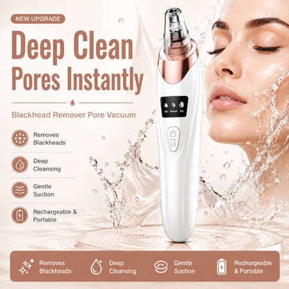 Blackhead Remover Vacuum – Rechargeable Pore Cleaner with Suction Control